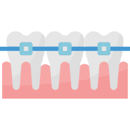 kawat gigi sanafa dental