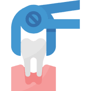 operasi gigi bungsu sanafa dental